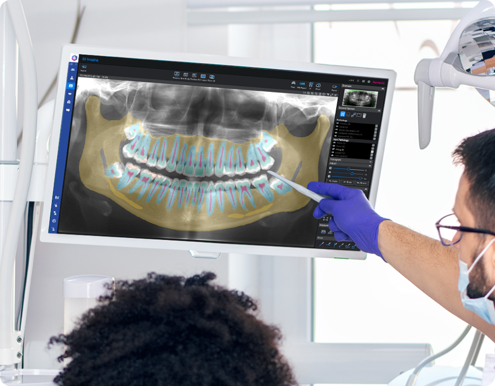 Pearl Ai For Romexis Request A Pearl Demo